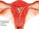 Saignements pendant la grossesse : faut-il s inquiter? - Femme