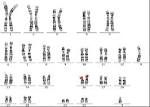 Biologie: Was ist diploider, homologer und haploid Chromosomen