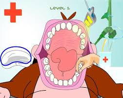 Resultado de imagen de DENTAL GAME