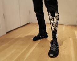 Prosthetics 3d printing