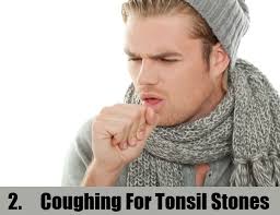 Image result for tonsil stones