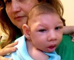 Image result for pictures of zika babies