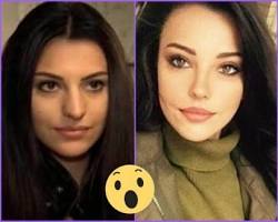 Tuvana Türkay estetiksiz ve estetikli hali resmi