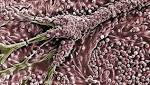  Albuminuria Increases Alzheimer's Disease & Vascular Dementia Risk