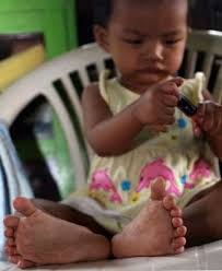 Lei Yadi Min Lei Yadi Min Has 26 Fingers And Toes: Photo LEI Yadi Min has seven toes on each foot. She has six fingers on each hand. - Lei-Yadi-Min