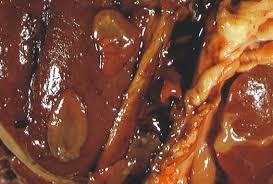 Znalezione obrazy dla zapytania fasciola hepatica