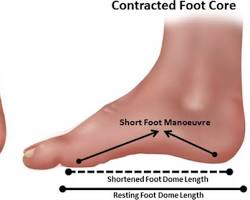 Short foot exercise