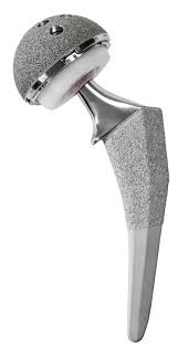 The History of Total Hip Replacement: A Revolutionary Step ...