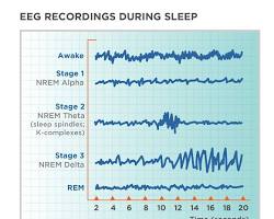 Image of sleep stages and brain activity