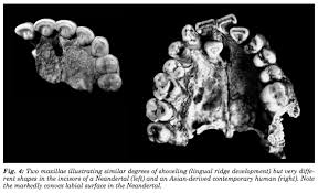 Résultat de recherche d'images pour "shovel shaped incisors"