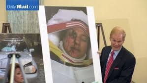 Image result for takata recall