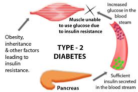 Image result for diabetes