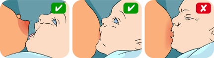 Image result for pelekapan yang betul