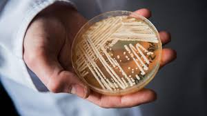 Cases of potentially deadly fungus detected in 27 states, CDC data shows. What to know
