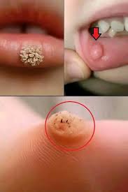 These are the first signs of an enf&hellip;See more