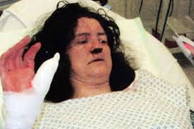 Catrin Roberts after she was attacked by husband Gwilym Euros Roberts - pics-image-2-573890456-2627404