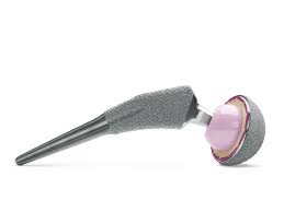 Taperloc® Complete Hip System | Zimmer Biomet
