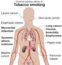 external image images?q=tbn:ANd9GcSA8QLohIE0YhwYSxQ609DwKGvvioB501W-YZG7rHYSqrNSe-W9