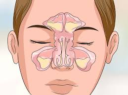 Image result for HIDUNG BERINGUS
