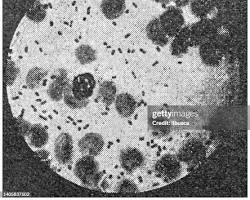 Image of bubonic plague microscopic images