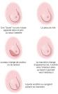 Symptmes - Cancer du sein Institut National Du Cancer