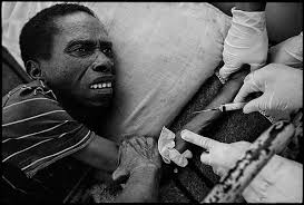 Image result for images of tuberculosis patients