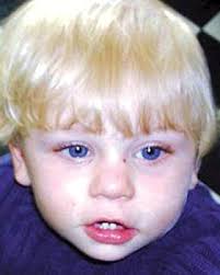 Image result for baby p