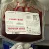 Story image for Cord Blood Transplant from KSAT San Antonio