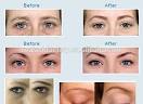 Eyebrow serum for growth