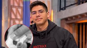 Así quedó la herida de Antrax tras ser atendido en una ambulancia durante el domingo de Eliminación de MasterChef 24/7 (FOTO)