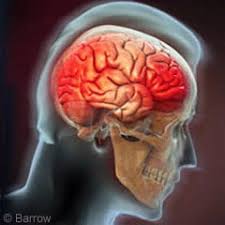 Traumatic Brain Injury Increases the Risk of Teen Substance Abuse