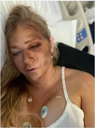 Epstein Accuser Virginia Giuffre Critically Injured, Claims Doctors Gave Her 'Days to Live' After Car Crash