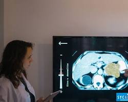 Image of IA utilizada para el tratamiento médico