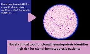 “Revolutionary Clinical Tool Identifies High-Risk Clonal Hematopoiesis Patients”