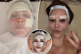 Kim Kardashian trying Korean beauty treatments