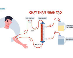 Hình ảnh về Thận lọc máu