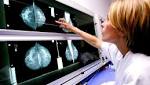  Breast cancer screenings missed by additional 50000 women due to error, doctor warns