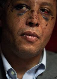 Tara Todras-Whitehill for The New York Times. Yehia Negm, a former diplomat, was detained and beaten. - CAIRO-articleInline