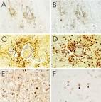 Non-specific binding of antibodies in immunohistochemistry