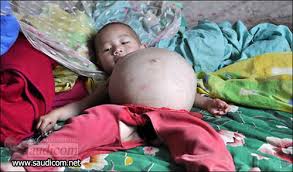 طفلة صينية عمرها سنة واحدة حامل !!!! Images?q=tbn:ANd9GcSMKOZigS31CwRqz7whjDc6bZnuAS_gbBo_YLmUNV880QA9v3-lYQ