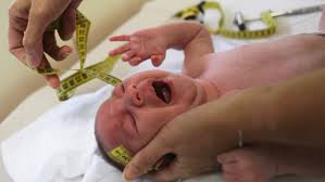 Image result wey dey for images of zika babies\