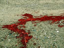 Image result for puddle of blood