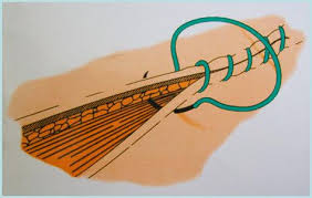 Image result for simple continuous suture pattern