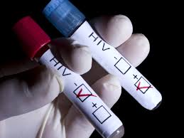 Image result for aids and hiv test