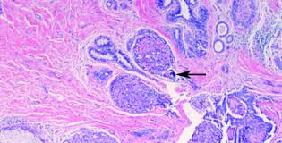 pathology এর চিত্র ফলাফল