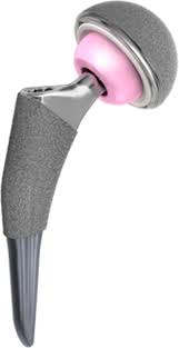 Primary total hip arthroplasty using a short bone-conserving ...