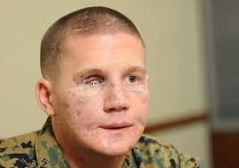 medal of honor. Marine Lance Cpl. Kyle Carpenter will receive the Medal of Honor for actions in combat in Marjah, Afghanistan. (Photo: Colin Kelly, Gannett) - 1400102045000-XXX-MIL-MARINE-MOH-012912-4-46676275