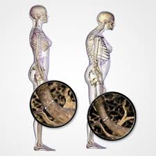 Image result for ‫ویتامین دی‬‎