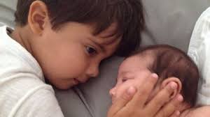 Image result for picture of BABIES WITH ZIKA VIRUS