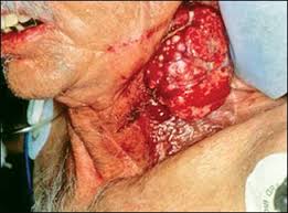 Image result for cancer hospital maharagama